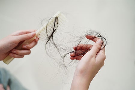 Hair Loss & Scalp Disorders